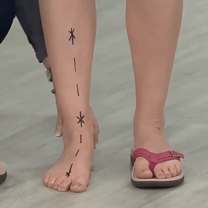 Orthopedic Toe Sandals for Maximum Comfort and Perfect Support for Stable Walking